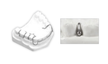 Ball clasps 0 7 mm  028
