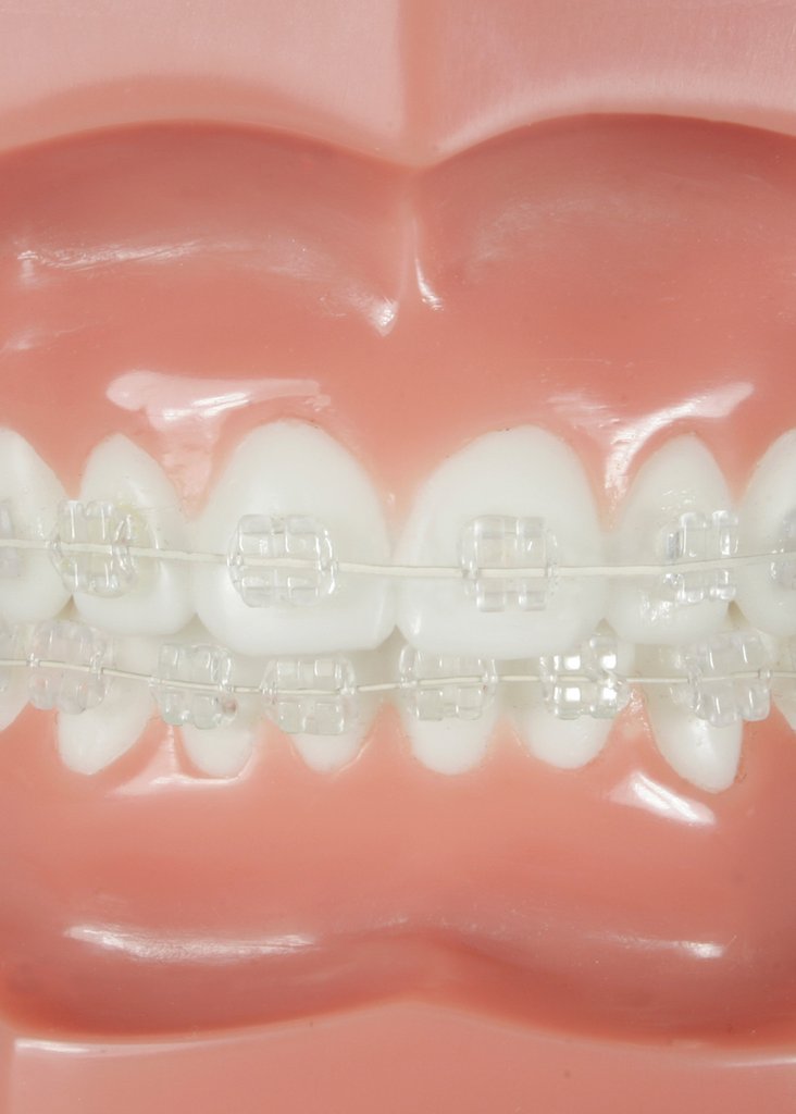 Caso Spa MBT Bkts  018 5-5 U/L HK s 3